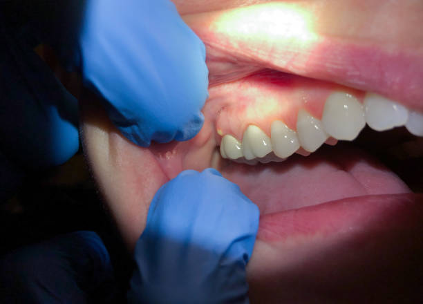 Best Teeth Whitening  in Montevlo, AL