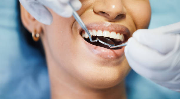 Best Dentist for Tooth Abscess  in Montevlo, AL